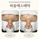 힐링비움 | 의정부 예신관리, 웨딩관리 l 비움에스테틱 솔직후기 (의정부 결혼관리 추천)