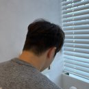 언론기관부설 | 순천두피관리 “WT메소드”에서 지루성 두피염, 남성탈모로 두피 스켈링받은 솔직후기