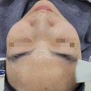 여드름살롱 네이버블로그