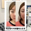 도곡2-102 | 도곡피부관리 | 약손명가 타워팰리스도곡점에서 작은얼굴관리 받고 온 후기