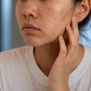힐메디 | 톡 바르고 자니 꿀피부, 메디테라피 톤업크림 핑크 트라넥삼산 후기