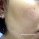 ㈜프라임에너지 | 요즘 저만 이렇게 관리하나요? 베리안 RF뷰티디바이스+앰플 후기