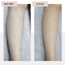 성지여자중학교 | 여름 준비 다리 왁싱