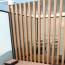 불광튼튼척의원 | 불광 정형외과 불광튼튼척의원 골프엘보 팔꿈치에서 느껴지는 불편