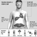 액상과당 섭취 시 유발되는 질환 이미지