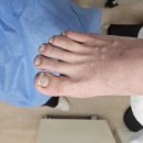 더블앤뷰티레푸스일산주엽점 | 겁쟁이 남편도 안심한 일산 내성발톱, 더블앤뷰티 레푸스 일산주엽점 솔직 후기