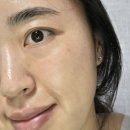 민감성, 시술 후에는 바이오더마 시카비오 트리플 딥 리페어 선크림으로 관리해요