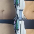 세라테라피 이미지
