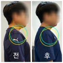 피지오짐 이미지