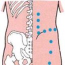지압 - 요 통(좌골신경통) 이미지