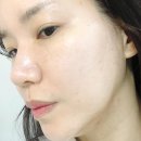 신사 가로수길 여드름관리에 제격인 뷰티건강연구소
