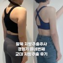 11545-12-02-21 | 람스 솔직후기 안 했으면 어땠을까? 운동 vs 람스 비교 (12주차 후기)