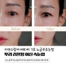 메디컬카운셀러 | 3초 붙이는 노글루속눈썹 투라 여신 속눈썹｜40대 처진 눈매 리프팅 효과 제대로 본 후기