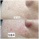 씨앤엘쁘띠 | 해남문제성피부관리 피부 고민 해결, 해남의 보석 씨앤엘쁘띠스킨케어 방문기