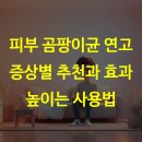 호평중앙약국 | 피부 곰팡이균 연고 증상별 추천과 효과 높이는 사용법