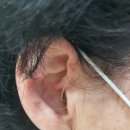 시그니아독일보청기대구북구센터 이미지