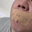 주식회사 숨앤케어 | 입술케어까지 한번에 코골이 방지 밴드 [입벌림방지밴드 립앤숨]