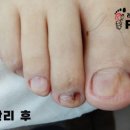 레푸스 사상점 이미지