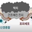 필링후 가려운 이유와 대처(연고를 사용할 경우의 주의 사항) 이미지