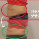 성북8 | 정형돈쥬비스성북점 60대 8kg감량후기