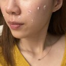 삼성서울리프앤톡스의원 | 여드름 아니 모낭염 아니 모공 아니...쏘의 피부일기 1탄