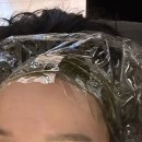 모코드두피탈모센터 이미지