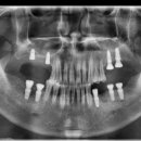 대구본플란트치과의원 이미지