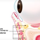 눈밑지방이식후기, 피부과에서 실제 사례 공개합니다