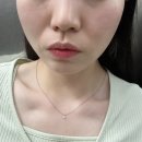유앤영피부과의원 | 웨딩촬영 본식 필수 예비신부 피부관리 LDM 관리 효과 / 유앤영피부과의원 노원점
