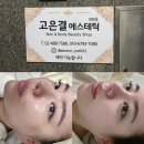 강동-천호-309 | 강동/천호 피부관리 고은결에스테틱 예신관리