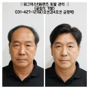 (주)마스타모터스서초점 | 서초구 가발 │ Before &amp; After 리얼 공개, 티 안 나게 변신