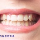 루미치과 네이버블로그