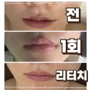 부산 입술반영구 립라인확장 더스케치 내돈내산 리터치 통증 후기 전후 가격