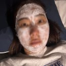 아임엣지 | 대구 울쎄라 보톡스 추천 엣지성형외과 후기