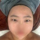 엔제이 | 구리피부관리 뷰티엔제이 솔직후기|승모근+팔뚝 웨딩관리로 라인 정리 끝판왕