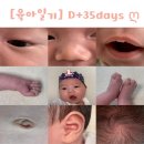 [육아일기][D+20일~35]신생아반사•잠투정•신생아통장•bcg주사•신생아졸업•순병원후기당첨