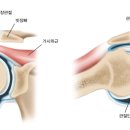 새로온한의원 네이버블로그