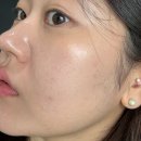 하남시한의원 다이어트 한약 유지기 식단