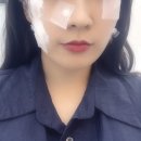 힐스바른의원 | 방학동 피부과 라클라라의원가서 내돈내산 레이저 시술했습니다! (편평사마귀, 비립종, 점제거, 여드름...