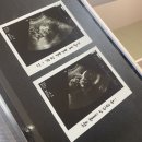 11620-4-38-4 | 임신 35, 36주 증상 및 기록, 몸무게, 막달검사, 임산부 방광염, 초음파 앨범, 한샘 보나 데이베드...