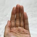 메디젠 | 메디젠 안티헤어로스세럼 후기 머리 빠짐 줄이기 두피관리 시작템 추천