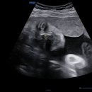 머슬제이 이미지