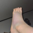 인성병원 | 삼재 근로자의 개박살난 인성으로 발등 골절 산재 입원 후기 [장림 한서병원]