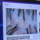 광명노인건강케어센터 | 광명 만족스러웠던 두피 케어 :: 웰킨 두피탈모센터 철산점