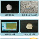 웰치과기공소 이미지