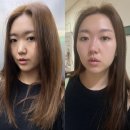 창원코필러 낮은코 시티세븐한의원 슬라인코 두번째 리얼후기