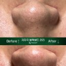 린앤스킨 네이버블로그