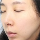 (주)비티엔 | 샤넬주사 반짝효과 걱정? 꾸준히 집에서 관리 나의 비법!