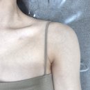 365플러스일산중산점 | [일산피부과]일산레이저제모는 젠틀맥스프로플러스로 여름맞이준비 겨드랑이제모