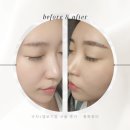 대구수지 | 대구 | 동구 자연스럽게 예쁜 눈썹문신 후기- 홍화뷰티(수지+엠보시술)